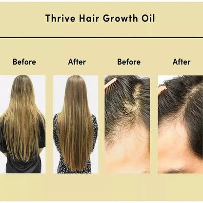 Thrive Hair Grown Oil